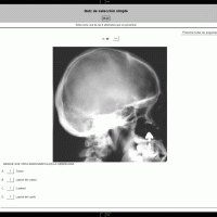 Identificando detalles anatómicos en radiografía lateral de cráneo