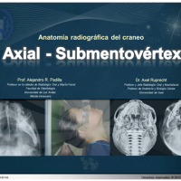Anatomía radiográfica en vista Axial - Submentovértex